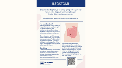 ileo